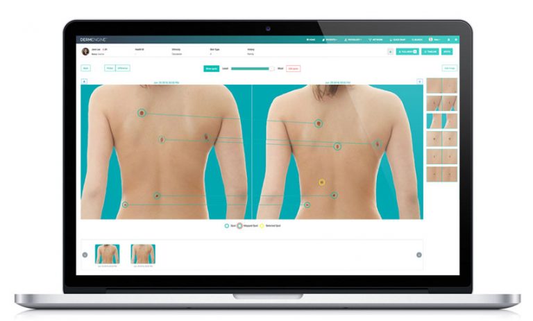 Skin Cancer Checks & Mole Mapping — Doctors of Northcote